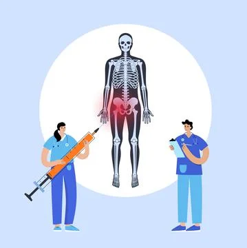 Hip joint injection Stockillustratie