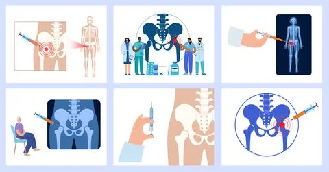 Hip joint injection Stock Illustration