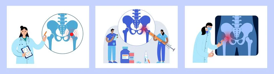 Hip joint injection イラスト素材