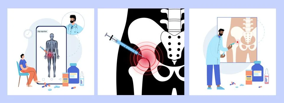 Hip joint injection Illustrazione stock