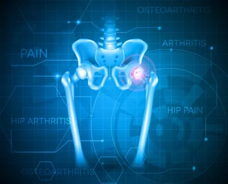 Hip pain background Stock Illustration