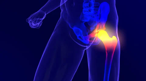 Hip pain Stock Footage