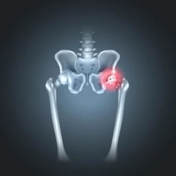 Hip pain Stock Illustration