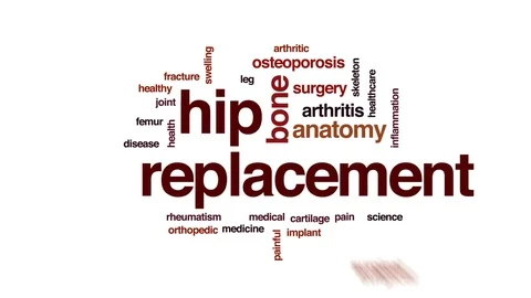 Hip replacement animated word cloud, text design animation. Stock Footage 76332914