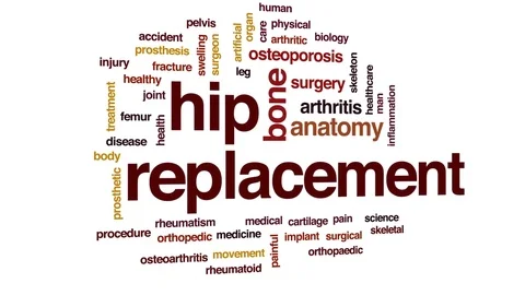 Hip replacement animated word cloud, text design animation. Stock Footage 76435172