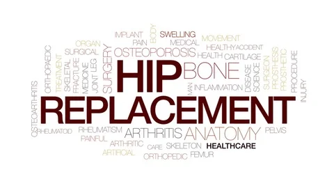 Hip replacement animated word cloud, text design animation. Kinetic typography. Stock Footage 76874696
