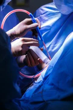 Hip replacement cement insertion and suction of fluids Stock Photos
