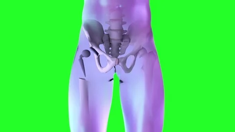 Hip replacement implant installed in the pelvis bone Stock Footage 84480258