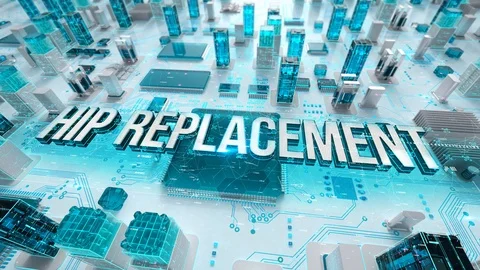 Hip Replacement with medical digital technology concept Stock Footage 106850392