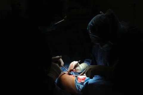  Hip replacement surgery. Hip prosthesis 016925 004  Stock Photos