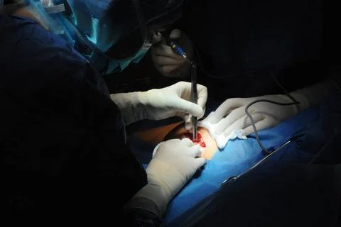 Hip replacement surgery. Hip prosthesis 016925 002   Stock Photos