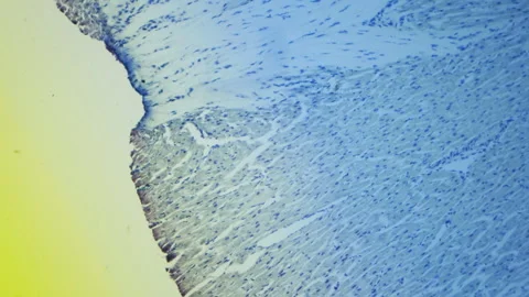 Histologic study of human heart muscle under a microscope. 100x magnification Stock Footage 265178558