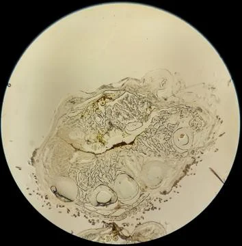 Histological cross-section of the tissue of a mouse leg under microscope Stock Photos