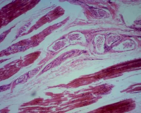 Histological Features of Human Eccrine Sweat Gland Stock Photos