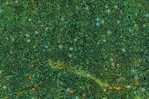 Histological slice of brain tissue Stock Photos