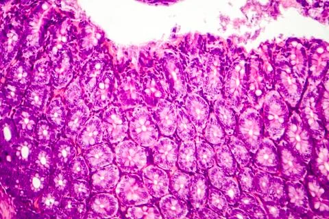 Histology of human appendix, micrograph showing Crypts of Lieberkuhn 库存照片