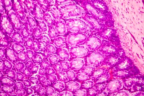 Histology of human appendix, micrograph showing Crypts of Lieberkuhn Foto stock