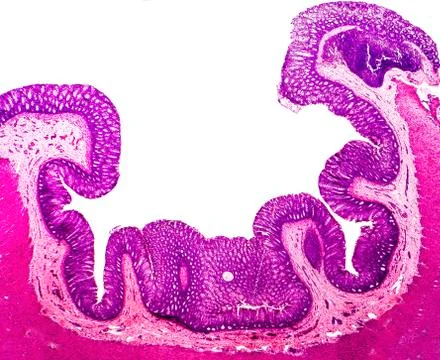 Histology of human appendix, micrograph showing Crypts of Lieberkuhn Foto stock