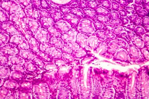 Histology of human appendix, micrograph showing Crypts of Lieberkuhn Stock Photos