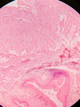 Histology of Normal Bladder Wall under the microscop 스톡 사진