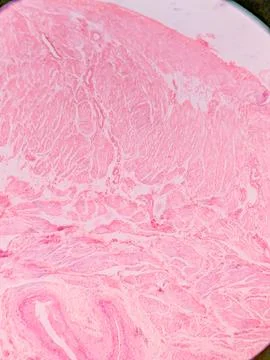 Histology of Normal Bladder Wall under the microscop Foto stock