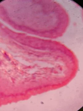 Histology of Normal Bladder Wall under the microscop 스톡 사진