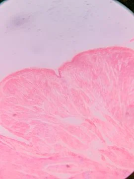 Histology of Normal Bladder Wall under the microscop 스톡 사진
