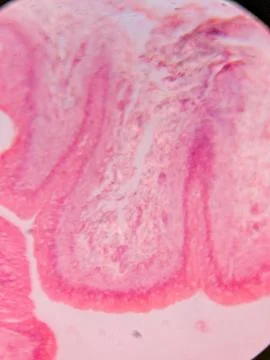 Histology of Normal Bladder Wall under the microscop 스톡 사진