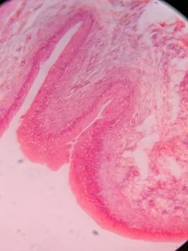 Histology of Normal Bladder Wall under the microscop 写真素材