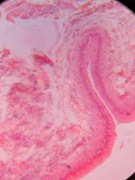 Histology of Normal Bladder Wall under the microscop 스톡 사진
