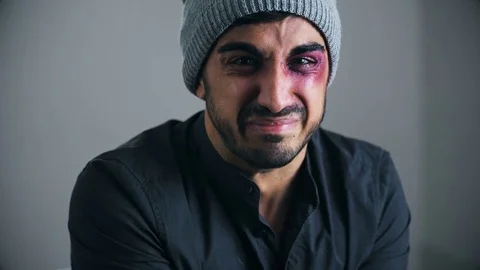 Hit and wounded man crying looking at the camera Stock Footage