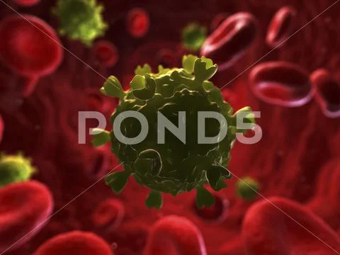 Hiv infection, artwork Stock Illustration