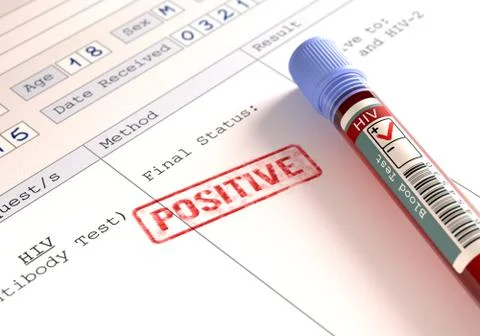 HIV Positive Stock Illustration