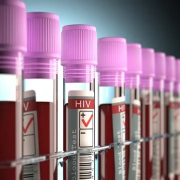 HIV Positive Stockillustratie