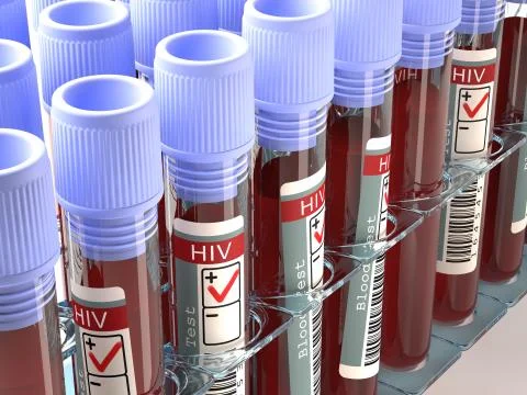 HIV Positive Stock Illustration