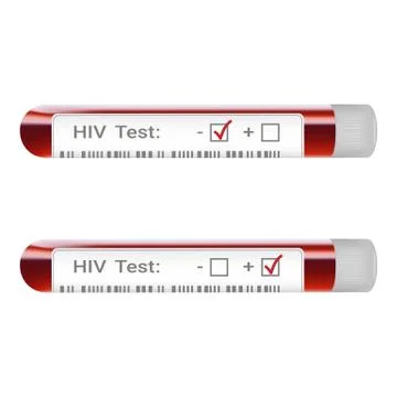 Hiv Screening Test Result Concept With Blood Collection Tube Indicating Hiv Stock Illustration