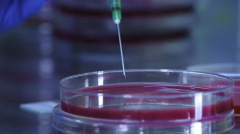HIV test - blood analysis Stock Footage 57768843