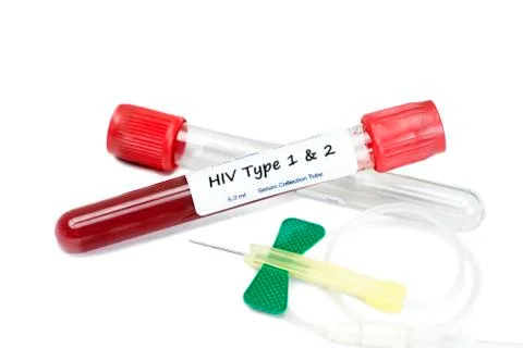 HIV Test Stock Photos