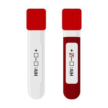 An HIV testing kit with a laboratory test tube for blood analysis. Vector Stock Illustration