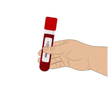 An HIV testing kit with a laboratory test tube for blood analysis. Vector Stock Illustration
