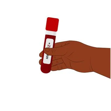 An HIV testing kit with a laboratory test tube for blood analysis. Vector Stock Illustration
