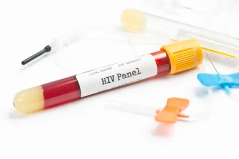 HIV Testing Foto stock