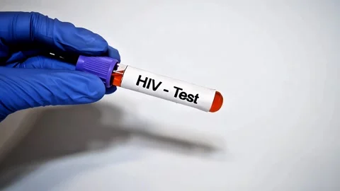 HIV virus test. AIDS Blood Test. aids test and blood tube test Stock Footage 307315353