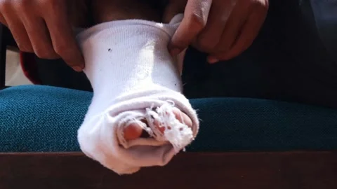Hole in worn out sock Stock Footage 336706949