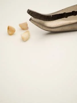 Home pulled teeth, teeth with pliers. 写真素材