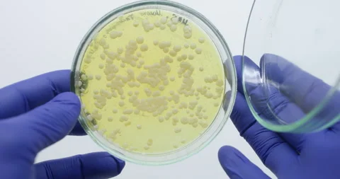 Homogeneous bacteria grew on agar. Stock Footage 310056635