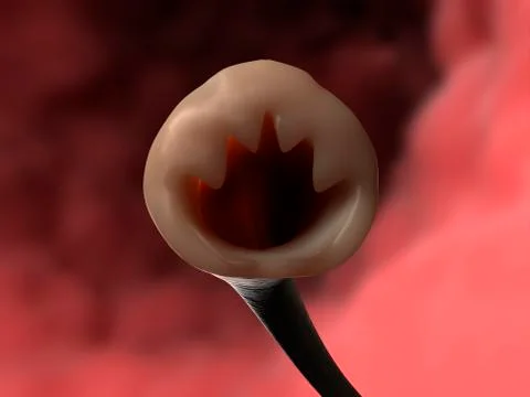 Hookworm head, artwork Stockillustratie