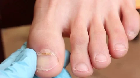 Horizontally split nail 库存影片 84208937