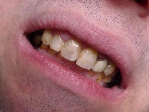 Horror smile Stock Photos