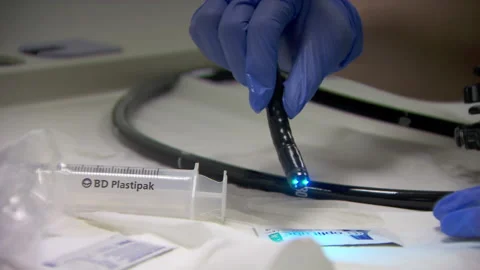 Hospital Endoscopy Camera Vídeos de archivo 146284450